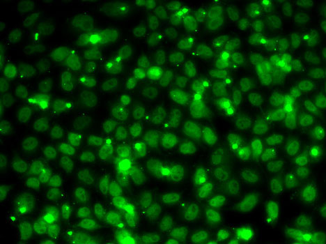 RPA3 Antibody - Immunofluorescence analysis of MCF7 cells using RPA3 antibody.