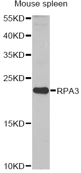 RPA3 Antibody - Western blot analysis of extracts of mouse spleen, using RPA3 antibody at 1:1000 dilution. The secondary antibody used was an HRP Goat Anti-Rabbit IgG (H+L) at 1:10000 dilution. Lysates were loaded 25ug per lane and 3% nonfat dry milk in TBST was used for blocking. An ECL Kit was used for detection and the exposure time was 60s.