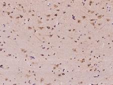 RPA3 Antibody - Immunochemical staining of human RPA3 in human brain with rabbit polyclonal antibody at 1:100 dilution, formalin-fixed paraffin embedded sections.