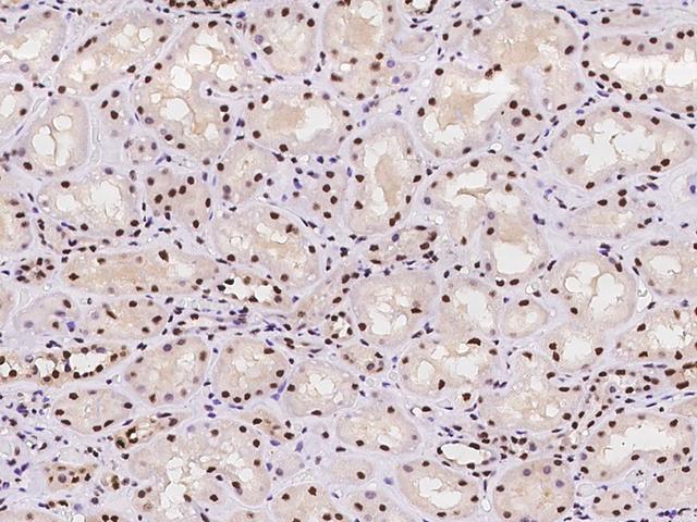 RPA3 Antibody - Immunochemical staining of human RPA3 in human kidney with rabbit polyclonal antibody at 1:100 dilution, formalin-fixed paraffin embedded sections.