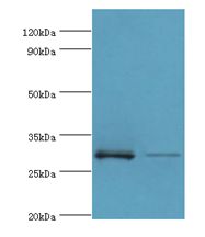 RPA4 Antibody - Western blot. All lanes: RPA4 antibody at 3 ug/ml. Lane 1: K562 whole cell lysate. Lane 2: mouse spleen tissue. Secondary antibody: Goat polyclonal to rabbit at 1:10000 dilution. Predicted band size: 29 kDa. Observed band size: 29 kDa.