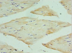 RPA4 Antibody - Immunohistochemistry of paraffin-embedded human skeletal muscle using antibody at 1:100 dilution.
