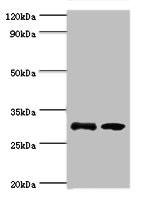 RPA4 Antibody - Western blot All lanes: RPA4 antibody at 3µg/ml Lane 1: K562 whole cell lysate Lane 2: Mouse spleen tissue Secondary Goat polyclonal to rabbit IgG at 1/10000 dilution Predicted band size: 29 kDa Observed band size: 29 kDa