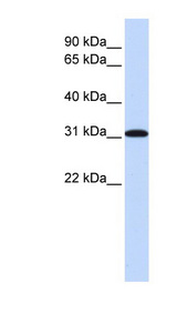 RPA4 Antibody - RPA4 antibody Western blot of HeLa lysate. This image was taken for the unconjugated form of this product. Other forms have not been tested.