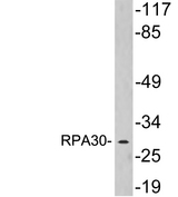 RPA4 Antibody - Western blot analysis of lysates from COLO205 cells, using RPA30 antibody.