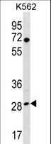 RPA4 Antibody - RPA4 Antibody western blot of K562 cell line lysates (35 ug/lane). The RPA4 antibody detected the RPA4 protein (arrow).