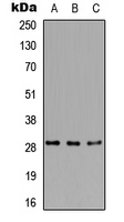 RPA4 Antibody - Western blot analysis of RPA4 expression in HEK293T (A); Raw264.7 (B); PC12 (C) whole cell lysates.