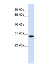 RPA4 Antibody - Fetal muscle lysate. Antibody concentration: 1.0 ug/ml. Gel concentration: 12%.  This image was taken for the unconjugated form of this product. Other forms have not been tested.