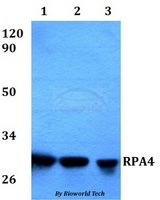 RPA4 Antibody - Western blot of RPA4 antibody at 1:500 dilution. Lane 1: HEK293T whole cell lysate. Lane 2: Raw264.7 whole cell lysate. Lane 3: PC12 whole cell lysate.