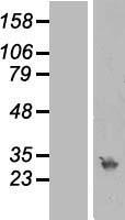 RPA4 Protein - Western validation with an anti-DDK antibody * L: Control HEK293 lysate R: Over-expression lysate