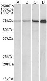 RPA70 / RPA1 Antibody - Goat Anti-RPA1 / RPA70 (aa323-337) Antibody (0.5µg/ml) staining of NIH3T3 (A), 3T3L1 (B), Mouse Lymph Node (C) and NSO (D) lysates (35µg protein in RIPA buffer). Primary incubation was 1 hour. Detected by chemiluminescencence.