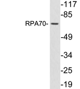 RPA70 / RPA1 Antibody - Western blot analysis of lysates from COLO205 cells, using RPA70 antibody.