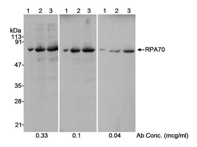 RPA70 / RPA1 Antibody - Detection of Human RPA70 by Western Blot. Samples: Whole cell lysate (10, 50 and 100 ug/lane in lanes 1, 2 and 3, respectively) from HeLa cells. Antibody: Affinity purified rabbit anti-RPA70 antibody used at the indicated concentrations. Detection: Chemiluminescence with a 10 second exposure.