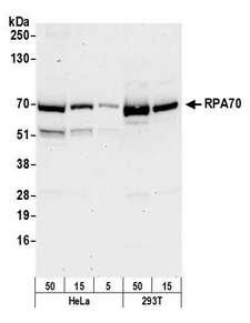 RPA70 / RPA1 Antibody - Detection of human RPA70 by western blot. Samples: Whole cell lysate (5, 15 and 50 µg) from HeLa and (15 and 50 µg) from HEK293T cells prepared using NETN lysis buffer. Antibody: Affinity purified rabbit anti-RPA70 antibody used for WB at 0.1 µg/ml. Detection: Chemiluminescence with an exposure time of 30 seconds.