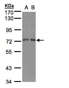 RPA70 / RPA1 Antibody - Sample (30 ug whole cell lysate). A: H1299, B: HeLa S3. 7.5% SDS PAGE. RPA70 / RPA1 antibody diluted at 1:1000