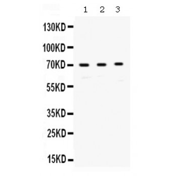 RPA70 / RPA1 Antibody - Western blot analysis of RPA70 expression in HELA whole cell lysates (lane 1), JURKAT whole cell lysates (lane 2) and COLO320 whole cell lysates (lane 3). RPA70 at 70 kD was detected using rabbit anti- RPA70 Antigen Affinity purified polyclonal antibody at 0.5 ug/mL. The blot was developed using chemiluminescence (ECL) method.