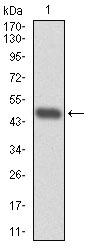 RPA70 / RPA1 Antibody - Western blot using RPA1 monoclonal antibody against human RPA1 (AA: 308-513) recombinant protein. (Expected MW is 48.3 kDa)