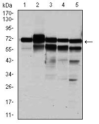 RPA70 / RPA1 Antibody - Western blot using RPA1 mouse monoclonal antibody against HeLa (1), MCF-7 (2), K562(3), A431(4), and COS-7 (6) cell lysate.