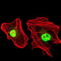 RPA70 / RPA1 Antibody - Immunofluorescence of HeLa cells using RPA1 mouse monoclonal antibody (green). Red: Actin filaments have been labeled with Alexa Fluor-555 phalloidin.