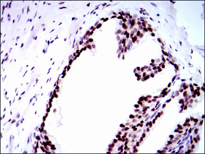 RPA70 / RPA1 Antibody - IHC of paraffin-embedded prostate tissues using RPA1 mouse monoclonal antibody with DAB staining.