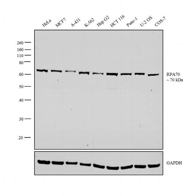 RPA70 / RPA1 Antibody - RPA70 Antibody in Western Blot (WB)