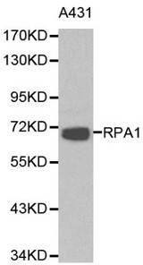 RPA70 / RPA1 Antibody - Western blot of RPA1 pAb in extracts from A431 cells.