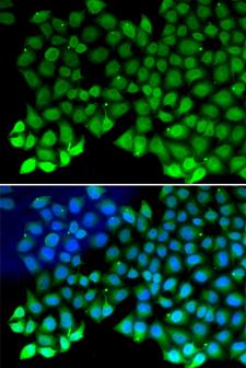 RPA70 / RPA1 Antibody - Immunofluorescence analysis of MCF-7 cells using RPA1 antibody. Blue: DAPI for nuclear staining.