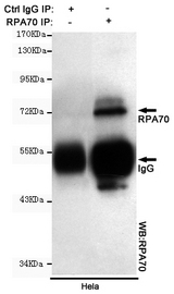 RPA70 / RPA1 Antibody - Immunoprecipitation analysis of HeLa cell lysates using RPA70 mouse monoclonal antibody.
