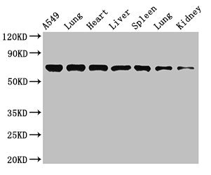 RPA70 / RPA1 Antibody - Western Blot Positive WB detected in: A549 whole cell lysate, Rat lung tissue, Mouse heart tissue, Mouse liver tissue, Mouse spleen tissue, Mouse lung tissue, Mouse kidney tissue All lanes: RPA1 antibody at 3.4µg/ml Secondary Goat polyclonal to rabbit IgG at 1/50000 dilution Predicted band size: 69 kDa Observed band size: 69 kDa