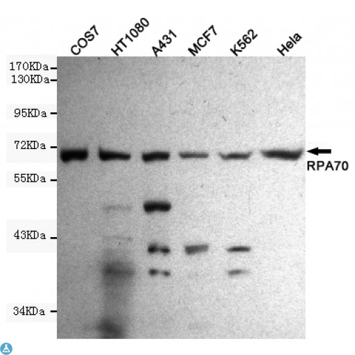 RPA70 / RPA1 Antibody - Western blot detection of RPA70 in Hela, A431, MCF7, COS7, HT1080 and K562 cell lysates using RPA70 mouse mAb (1:1000 diluted). Predicted band size: 70KDa. Observed band size: 70KDa.