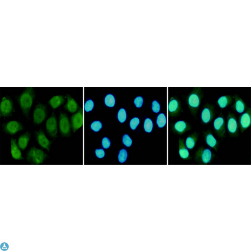 RPA70 / RPA1 Antibody - Immunocytochemistry staining of HeLa cells fixed in 1% Paraformaldehyde and using RPA70 mouse mAb (dilution 1:100).