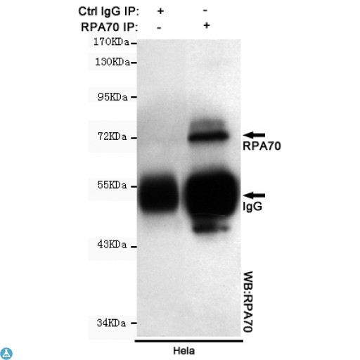 RPA70 / RPA1 Antibody - Immunoprecipitation analysis of Hela cell lysates using RPA70 mouse mAb.