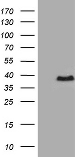 RPAIN Antibody - HEK293T cells were transfected with the pCMV6-ENTRY control. (Left lane) or pCMV6-ENTRY RPAIN. (Right lane) cDNA for 48 hrs and lysed. Equivalent amounts of cell lysates. (5 ug per lane) were separated by SDS-PAGE and immunoblotted with anti-RPAIN. (1:500)