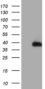 RPAIN Antibody - HEK293T cells were transfected with the pCMV6-ENTRY control. (Left lane) or pCMV6-ENTRY RPAIN. (Right lane) cDNA for 48 hrs and lysed. Equivalent amounts of cell lysates. (5 ug per lane) were separated by SDS-PAGE and immunoblotted with anti-RPAIN. (1:500)