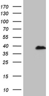 RPAIN Antibody - HEK293T cells were transfected with the pCMV6-ENTRY control. (Left lane) or pCMV6-ENTRY RPAIN. (Right lane) cDNA for 48 hrs and lysed. Equivalent amounts of cell lysates. (5 ug per lane) were separated by SDS-PAGE and immunoblotted with anti-RPAIN. (1:2000)