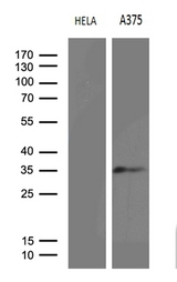 RPAIN Antibody - Western blot analysis of extracts. (35ug) from 2 different cell lines by using anti-RPAIN monoclonal antibody. (1:500)