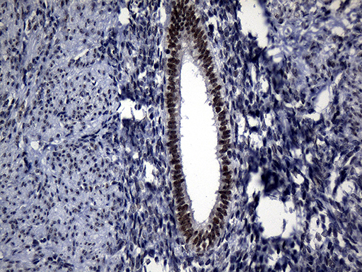 RPAIN Antibody - Immunohistochemical staining of paraffin-embedded Human endometrium tissue within the normal limits using anti-RPAIN mouse monoclonal antibody. (Heat-induced epitope retrieval by 1mM EDTA in 10mM Tris buffer. (pH8.5) at 120°C for 3 min. (1:500)