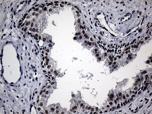 RPAIN Antibody - Immunohistochemical staining of paraffin-embedded Human prostate tissue within the normal limits using anti-RPAIN mouse monoclonal antibody. (Heat-induced epitope retrieval by 1mM EDTA in 10mM Tris buffer. (pH8.5) at 120°C for 3 min. (1:500)