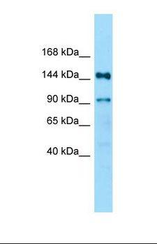 RPAP1 Antibody - Western blot of Fetal Kidney. Ndufaf5 antibody dilution 1.0 ug/ml.  This image was taken for the unconjugated form of this product. Other forms have not been tested.