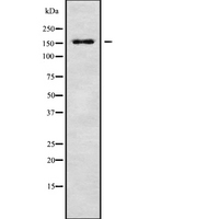 RPAP1 Antibody - Western blot analysis of RPAP1 using MCF-7 whole cells lysates