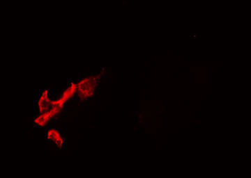 RPAP2 Antibody - Staining 293 cells by IF/ICC. The samples were fixed with PFA and permeabilized in 0.1% Triton X-100, then blocked in 10% serum for 45 min at 25°C. The primary antibody was diluted at 1:200 and incubated with the sample for 1 hour at 37°C. An Alexa Fluor 594 conjugated goat anti-rabbit IgG (H+L) antibody, diluted at 1/600, was used as secondary antibody.