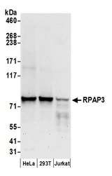 RPAP3 / FLJ21908 Antibody - Detection of human RPAP3 by western blot. Samples: Whole cell lysate (50 µg) from HeLa, HEK293T, and Jurkat cells prepared using NETN lysis buffer. Antibody: Affinity purified rabbit anti-RPAP3 antibody used for WB at 0.1 µg/ml. Detection: Chemiluminescence with an exposure time of 30 seconds.