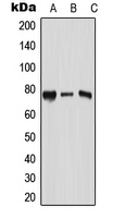 RPAP3 / FLJ21908 Antibody - Western blot analysis of RPAP3 expression in Jurkat (A); Raw264.7 (B); mouse kidney (C) whole cell lysates.