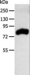 RPAP3 / FLJ21908 Antibody - Western blot analysis of Mouse kidney tissue, using RPAP3 Polyclonal Antibody at dilution of 1:400.