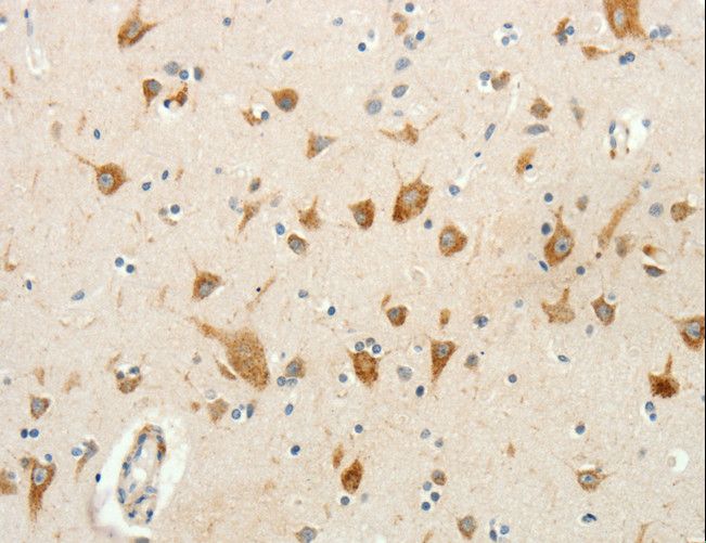 RPAP3 / FLJ21908 Antibody - Immunohistochemistry of paraffin-embedded Human brain using RPAP3 Polyclonal Antibody at dilution of 1:20.