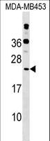 RPB16 / POLR2D Antibody - POLR2D Antibody western blot of MDA-MB453 cell line lysates (35 ug/lane). The POLR2D antibody detected the POLR2D protein (arrow).