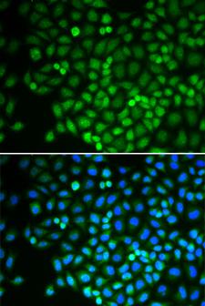 RPB16 / POLR2D Antibody - Immunofluorescence analysis of U2OS cells.