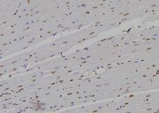 RPB16 / POLR2D Antibody - 1:100 staining rat heart tissue by IHC-P. The sample was formaldehyde fixed and a heat mediated antigen retrieval step in citrate buffer was performed. The sample was then blocked and incubated with the antibody for 1.5 hours at 22°C. An HRP conjugated goat anti-rabbit antibody was used as the secondary.