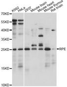 RPE Antibody - Western blot analysis of extracts of various cell lines, using RPE antibody at 1:1000 dilution. The secondary antibody used was an HRP Goat Anti-Rabbit IgG (H+L) at 1:10000 dilution. Lysates were loaded 25ug per lane and 3% nonfat dry milk in TBST was used for blocking. An ECL Kit was used for detection and the exposure time was 5s.
