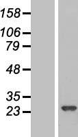 RPE Protein - Western validation with an anti-DDK antibody * L: Control HEK293 lysate R: Over-expression lysate